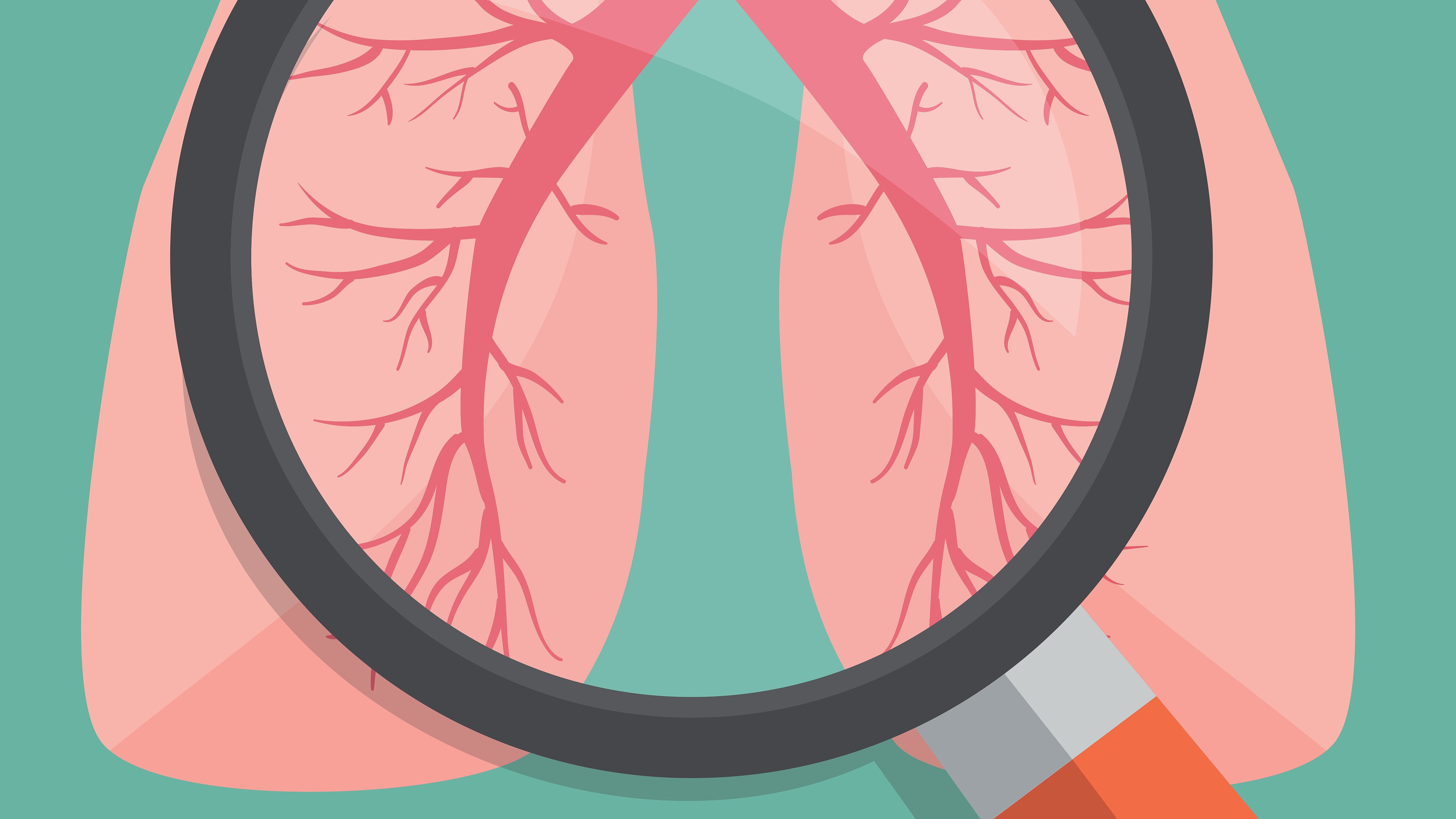 Illustration einer Lunge mit Lupe zur Darstellung von Lungengesundheit, Diagnostik und Früherkennung von Lungenerkrankungen.