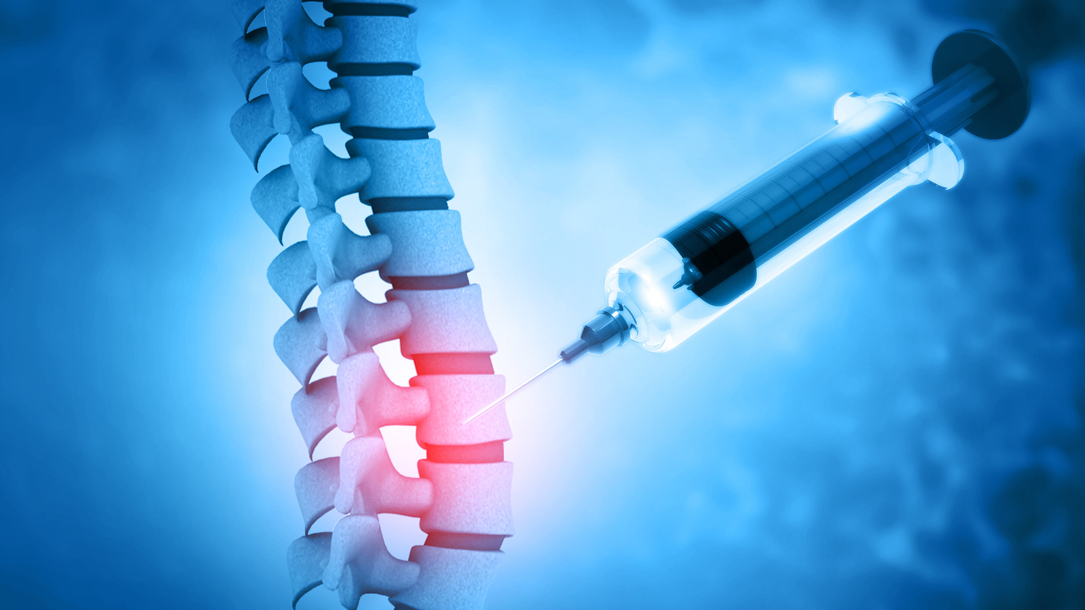 Illustration of a spine with a highlighted spinal disc and a syringe administering an injection.