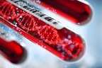 Adobestock-202377709-von-connect-world-klein2